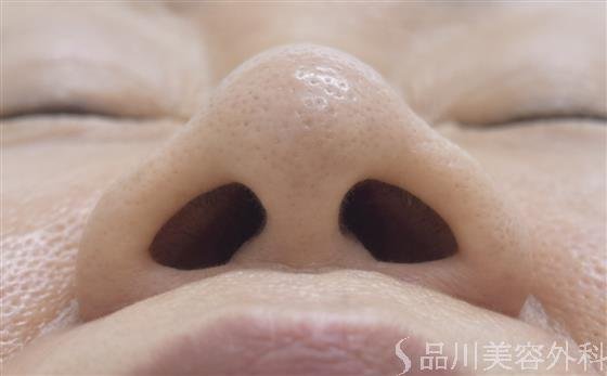 症例NO.45239のBEFORE写真