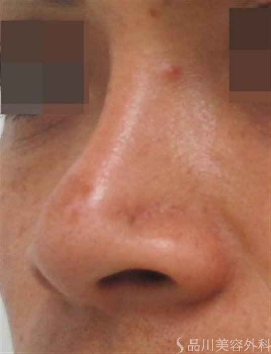 症例NO.21357のBEFORE写真