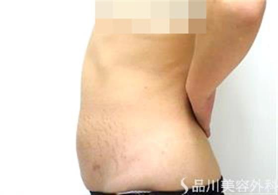 症例NO.21738のAFTER写真