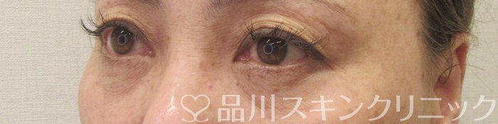 症例NO.70129のBEFORE写真