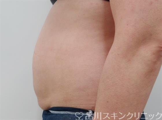 症例NO.27575のAFTER写真