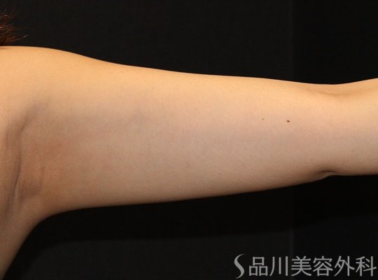 症例NO.73029のAFTER写真