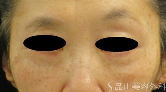 症例NO.47259のAFTER写真