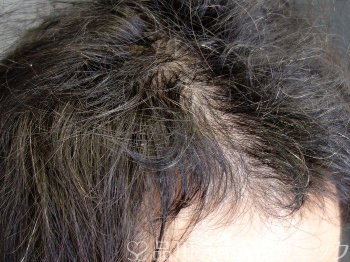 症例NO.73493のBEFORE写真