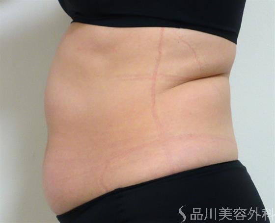 症例NO.41266のBEFORE写真