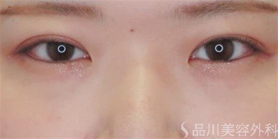 症例NO.48196のAFTER写真
