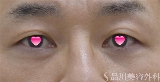 症例NO.50256のAFTER写真