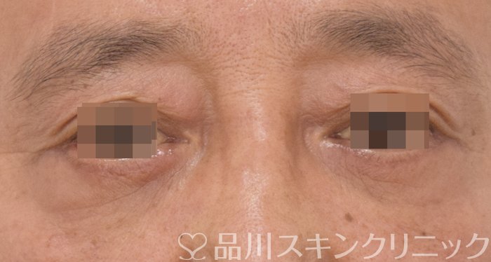 症例NO.70793のAFTER写真