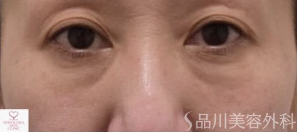 症例NO.72271のBEFORE写真