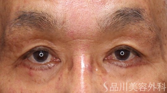 症例NO.69204のAFTER写真