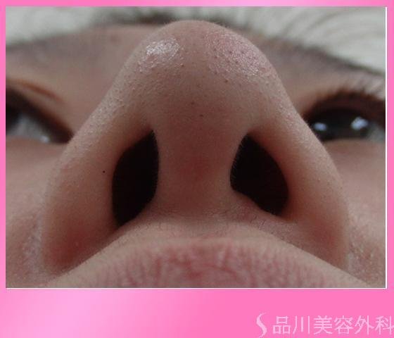 症例NO.7129のAFTER写真