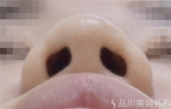 症例NO.49319のBEFORE写真