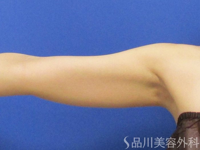 症例NO.67795のBEFORE写真