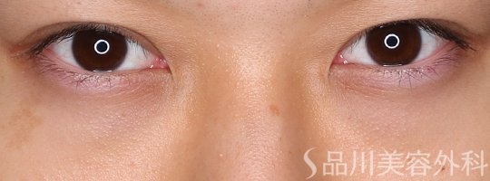 症例NO.71912のAFTER写真