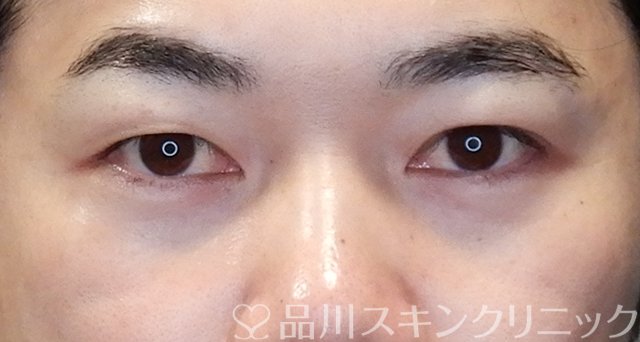 症例NO.67688のAFTER写真