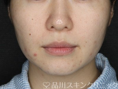 症例NO.71902のBEFORE写真