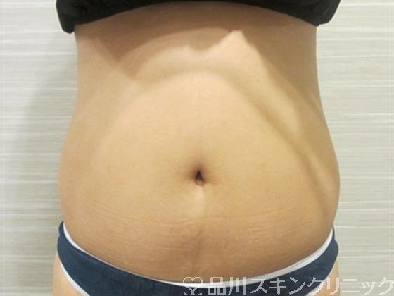 症例NO.34724のBEFORE写真