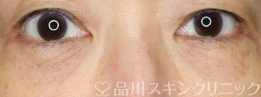 症例NO.67639のAFTER写真