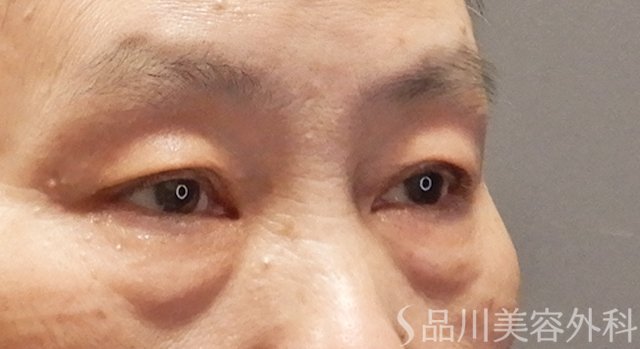 症例NO.73848のBEFORE写真