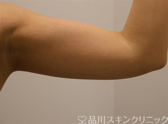 症例NO.40738のAFTER写真