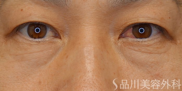 症例NO.71953のBEFORE写真