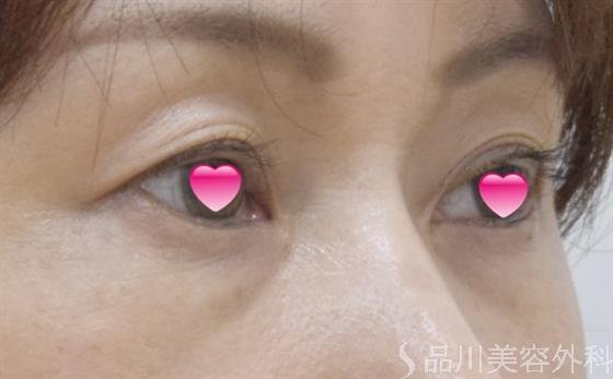 症例NO.50257のBEFORE写真