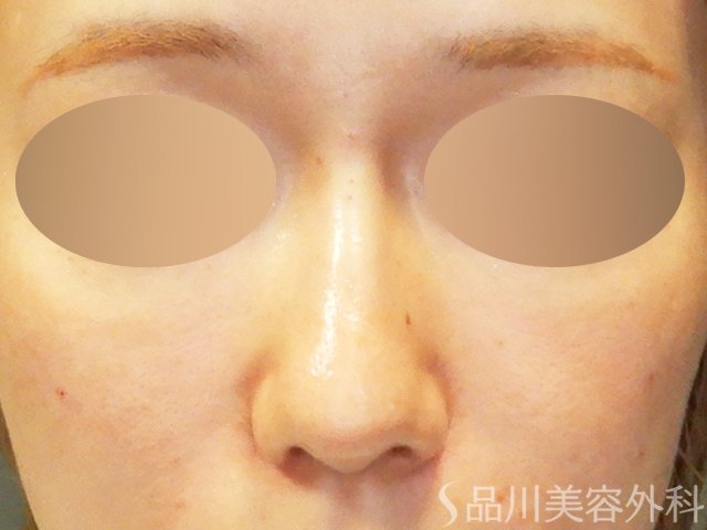 症例NO.67901のAFTER写真