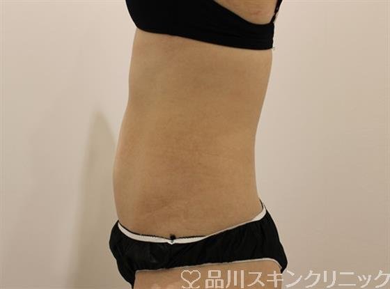 症例NO.49133のBEFORE写真