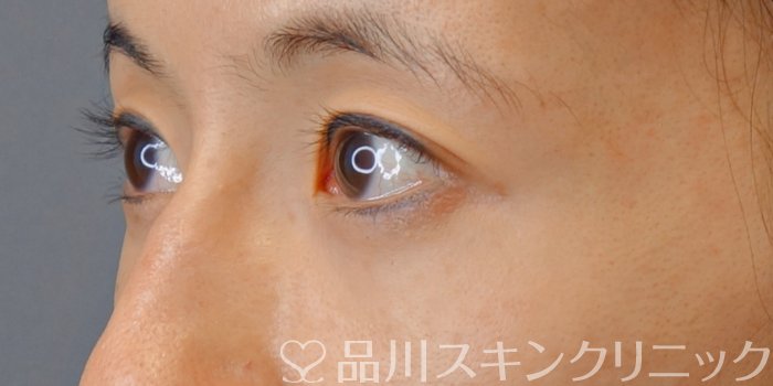 症例NO.73839のBEFORE写真