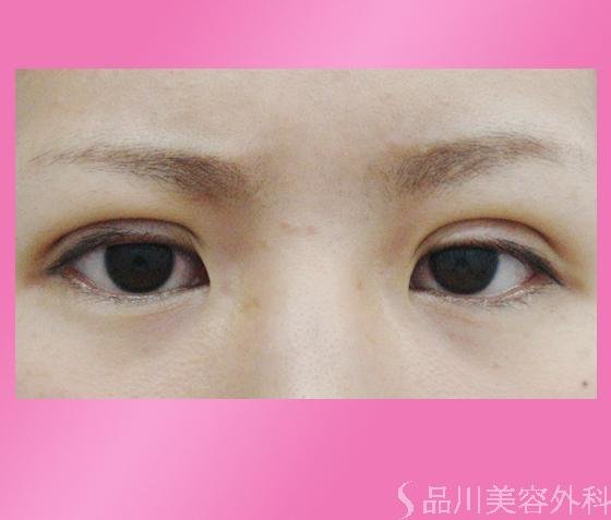 症例NO.859のAFTER写真