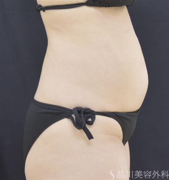 症例NO.45067のBEFORE写真