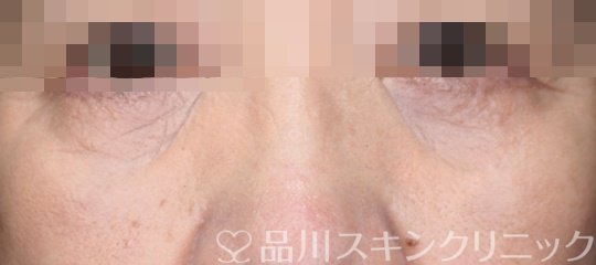 症例NO.63860のAFTER写真