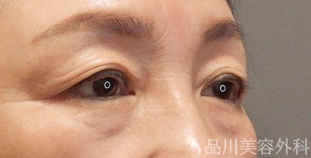 症例NO.73283のBEFORE写真