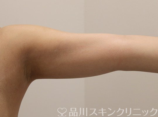 症例NO.72654のBEFORE写真