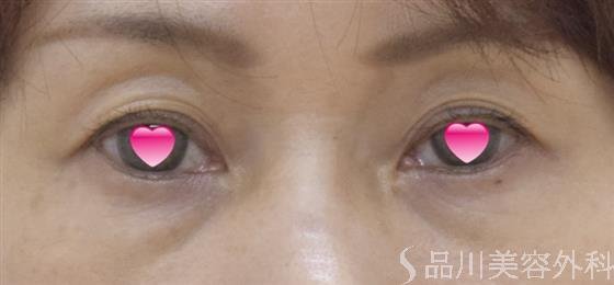 症例NO.50257のBEFORE写真