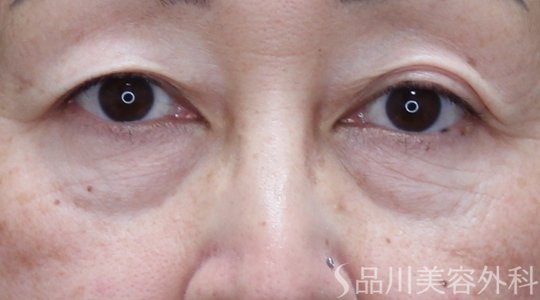 症例NO.73540のBEFORE写真