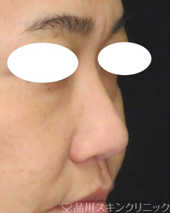 症例NO.70192のBEFORE写真