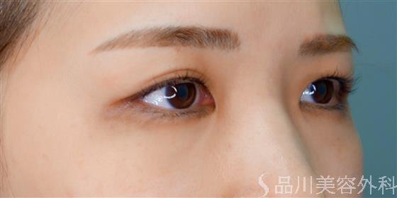 症例NO.53664のBEFORE写真