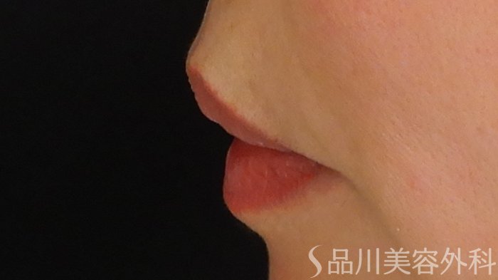 症例NO.69769のBEFORE写真