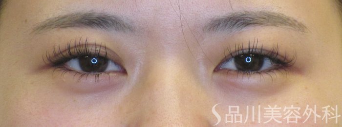 症例NO.71119のBEFORE写真