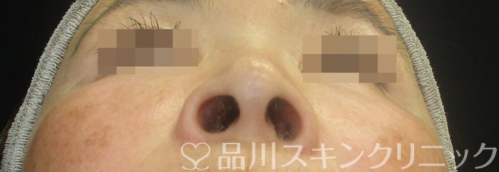 症例NO.73932のBEFORE写真