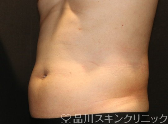 症例NO.74391のBEFORE写真
