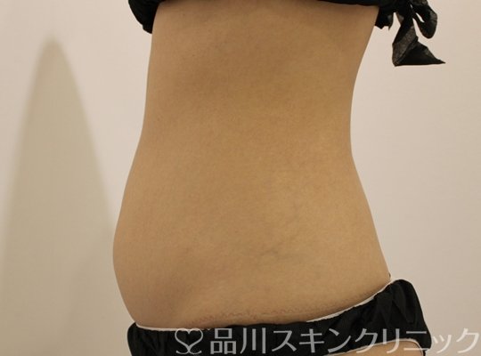 症例NO.73004のBEFORE写真