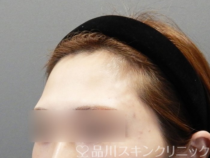 症例NO.73207のAFTER写真