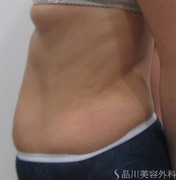 症例NO.22506のAFTER写真
