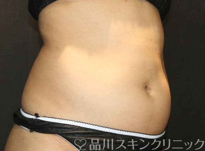 症例NO.73133のBEFORE写真