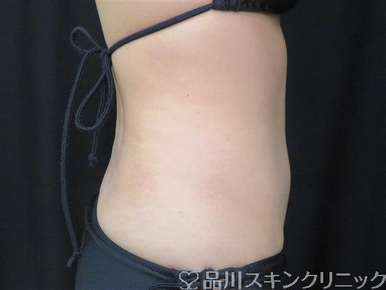 症例NO.59189のBEFORE写真