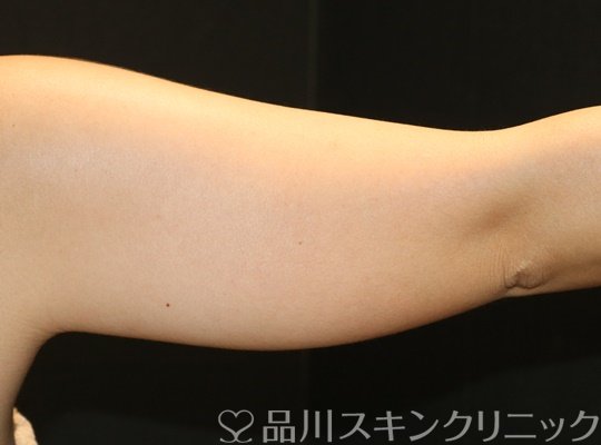 症例NO.71169のBEFORE写真