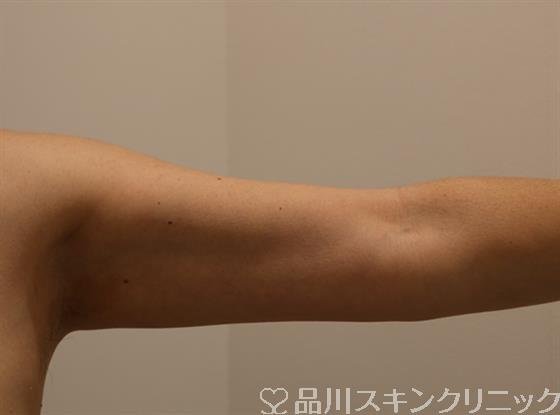 症例NO.40831のAFTER写真