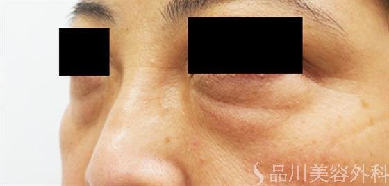 症例NO.39676のBEFORE写真
